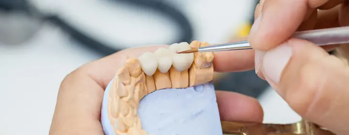 Dental Prosthetics